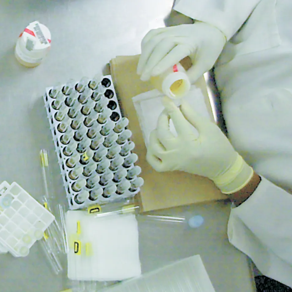 Lab testing urine samples